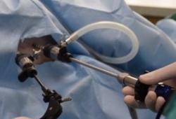 laparoscopic spay